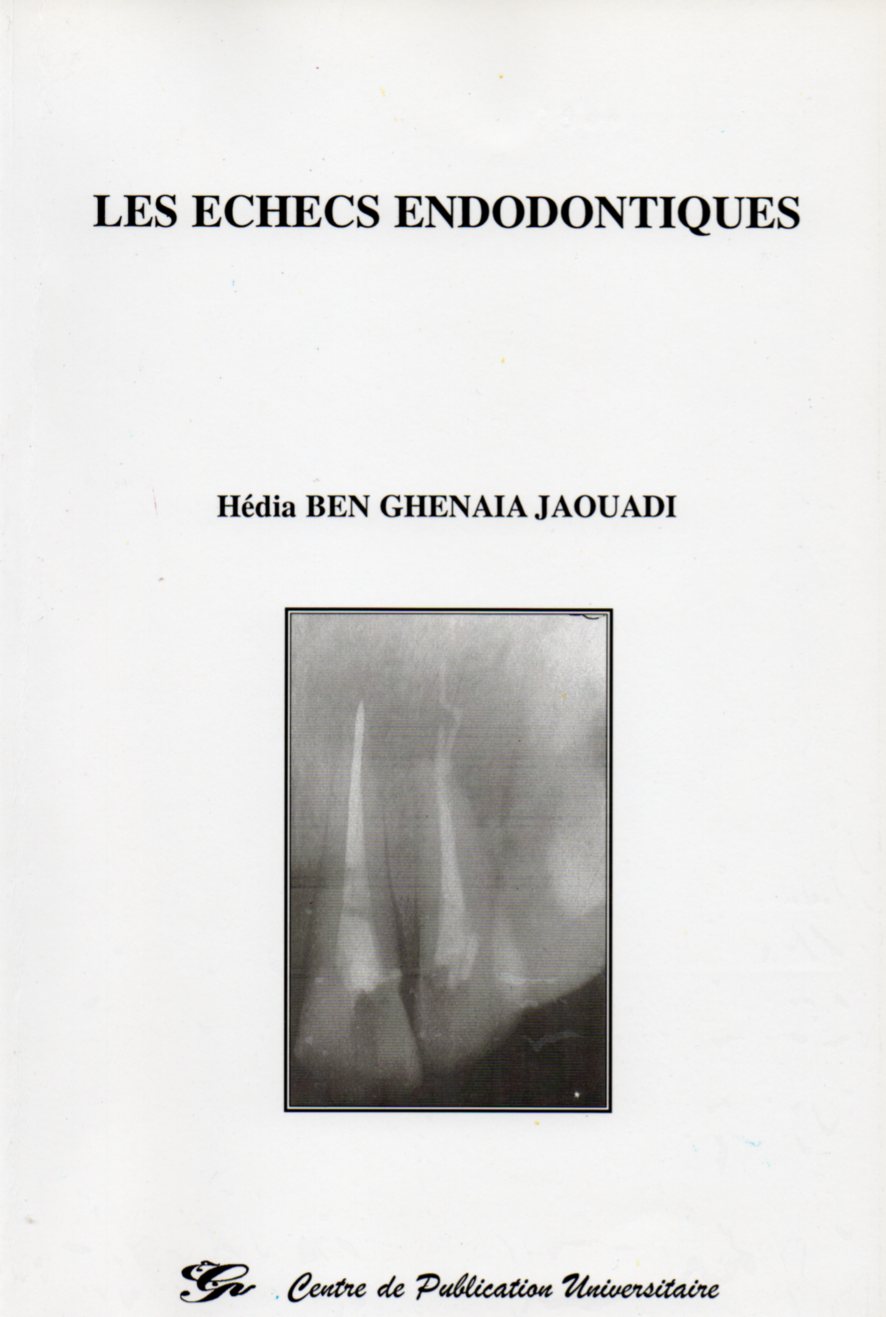 Les échecs endodontiques